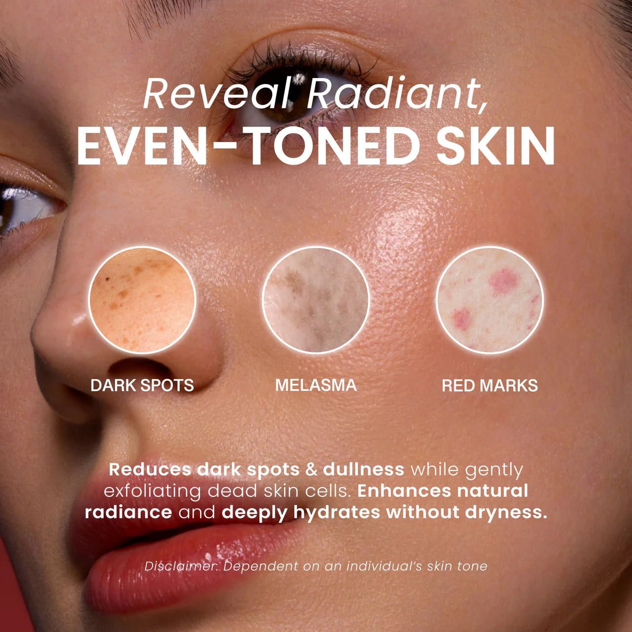 Turmeric & kojic acid soap